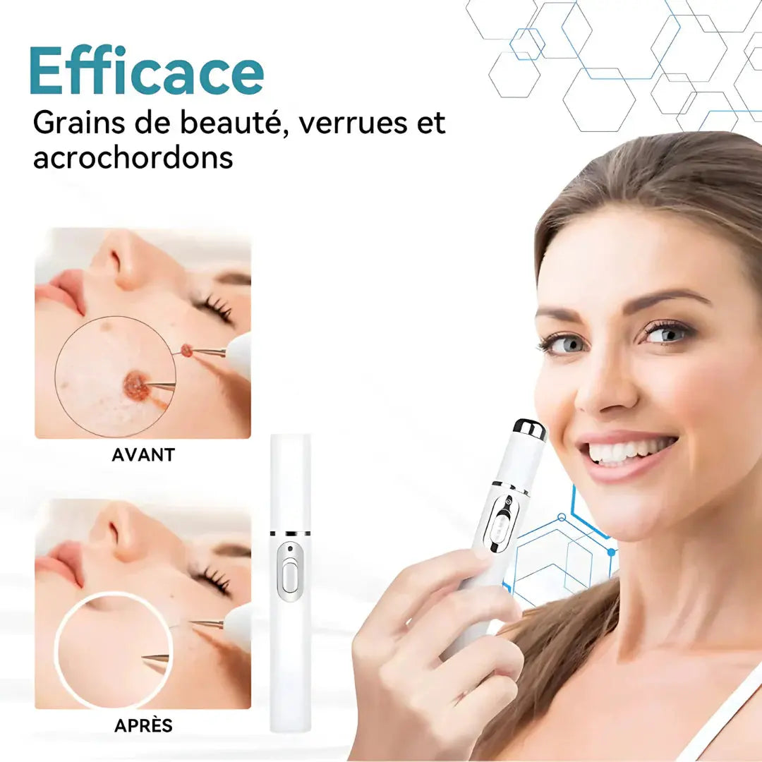 Stylo Soin Anti-Taches NovaPlace