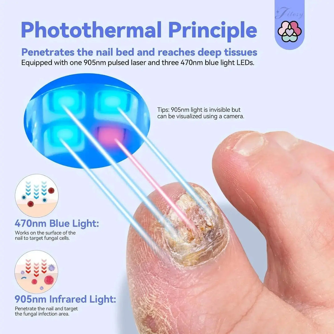 Traitement Lumineux pour Ongles Abîmés NovaPlace