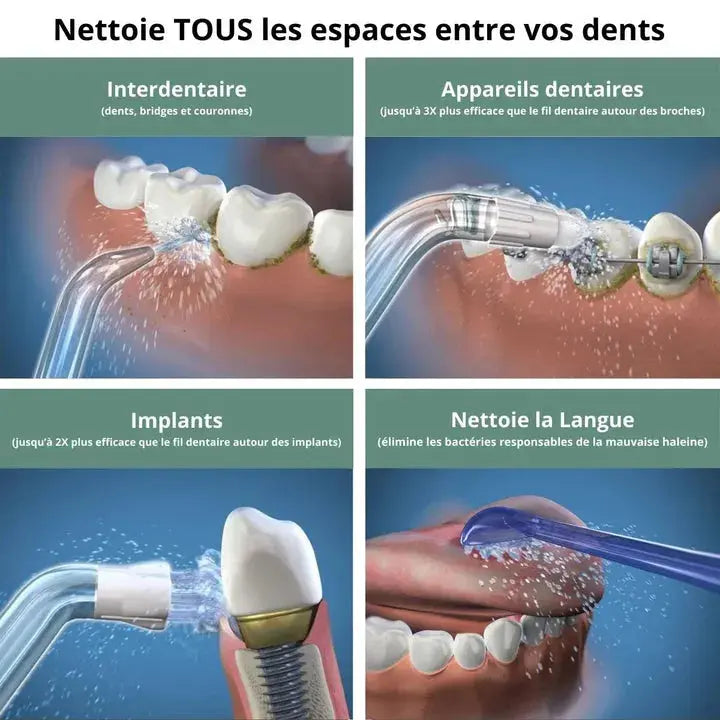 Hydropulseur Dentaire Rechargeable NovaPlace